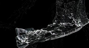 numb res